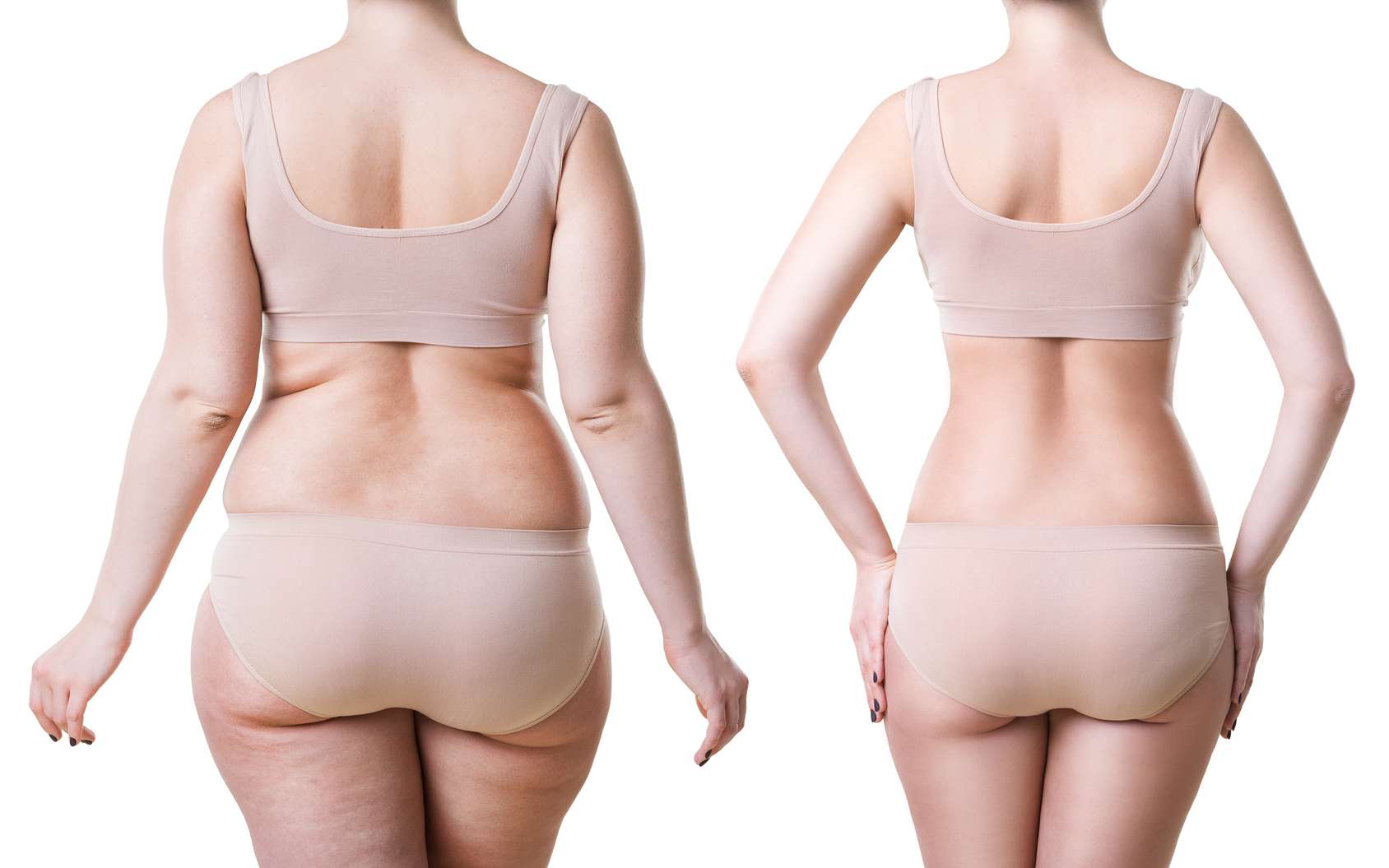liposuccion ventre tunisie