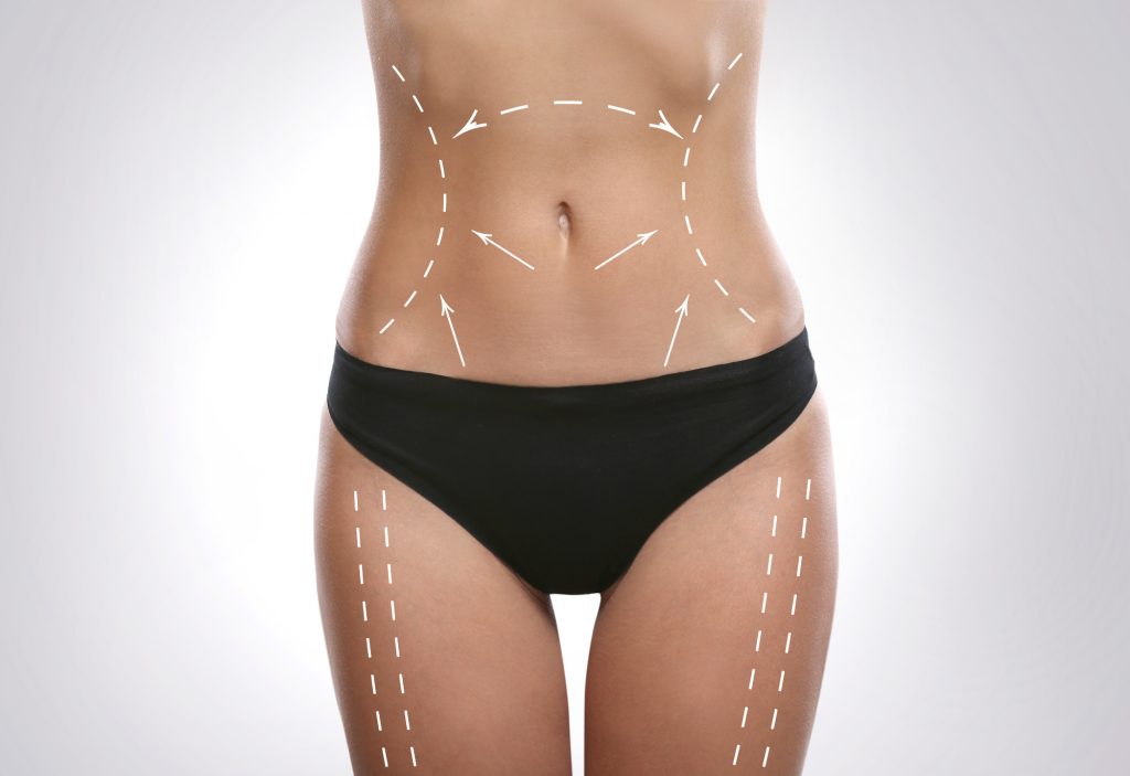 body lift prix Tunisie