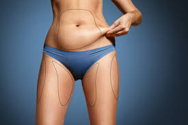 Power-Assisted Lipo (PAL) Tunisie