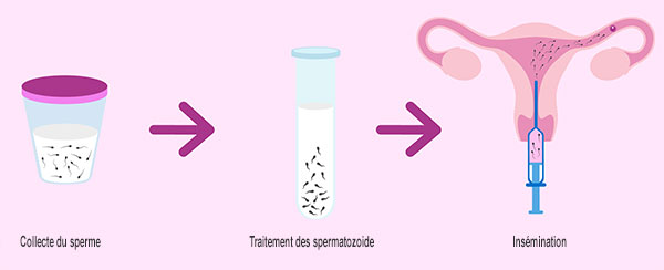 insemination artificielle tunisie insemination artificielle tunisie