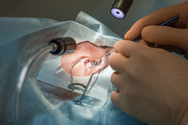 Implants ARTISAN Implants ARTISAN